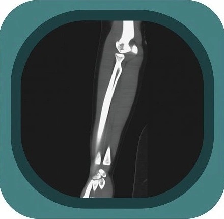 CT forearm anatomy icon